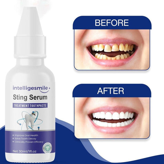 Intelligesmile Sting Serum Treatment Toothpaste 60ml (Pack of 2)